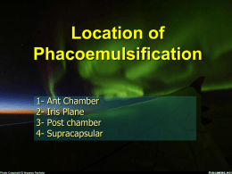 Location of Phaloemulsification