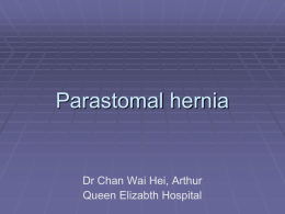 Parastomal hernia
