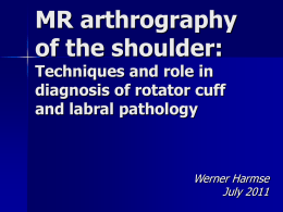 MR arthrography of the shoulder: Techniques and role in