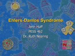 Ehlers-Danlos Syndrome