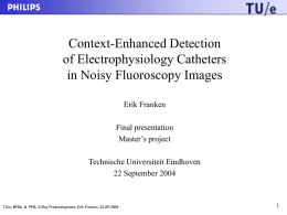 Detection of Catheters in Noisy Fluoroscopy Images