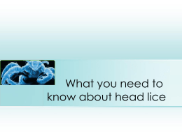 What you need to know about head lice