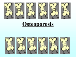osteoporosis - WA Centre for Health and Ageing