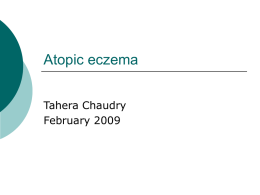 Atopic eczema - Audley Mills