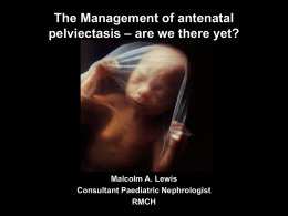 The Management of antenatal pelviectasis – are we there yet?