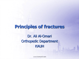 Principles of fractures