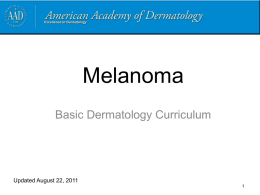 Melanoma - American Academy of Dermatology