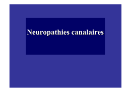 neuropathies canalaires
