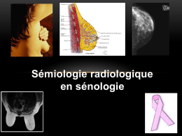 Sémiologie radiologique en sénologie