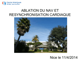 Ablation du nav et resynchronisation cardiaque dr lanfranchi