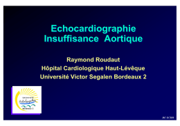 Insuffisance aortique (Pr. Roudaut)