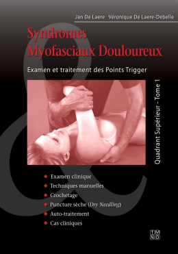 Syndromes Myofasciaux Douloureux