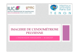 DPC endometriose version b light.pptx
