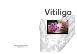 Vitiligo Broschyr - Svenska Vitiligoförbundet