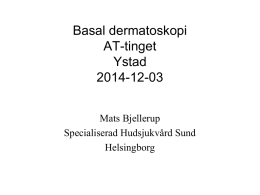 Basal dermatoskopi AT-tinget Ystad 2014-12-03