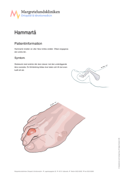 Hammartå - Margretelundskliniken Ortopedi & Idrottsmedicin
