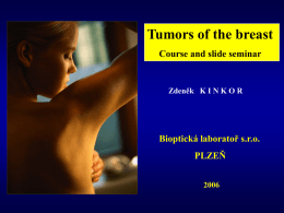 Breast tumors