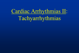 D-tachycardialecture - Digital Diagnostiks
