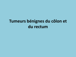 Tumeurs bénignes du côlon et du rectum
