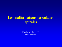 Les malformations vasculaires spinales