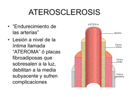 Aterosclerosis iam aneurismas