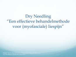 Dry Needling “ een effectieve behandelmethode voor myofasciale