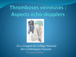 Thromboses veineuses profondes : les situations difficiles