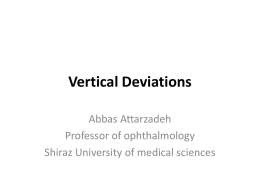 Vertical-Deviations-1390