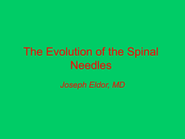 The Evolution of the Spinal Needles Joseph Eldor, MD   An Inguinal Hernia operation in 1382…Without Spinal needles   Valsalva, in 1682, was the first to remark.