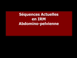 Séquences Actuelles en IRM Abdomino-pelvienne • Qualité intrinsèque de l’ IRM : Excellente résolution en contraste  • Impératifs de l’imagerie abdominopelvienne et vasculaire : Obtention.