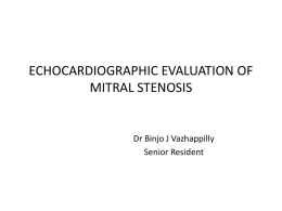 ECHOCARDIOGRAPHIC EVALUATION OF MITRAL STENOSIS  Dr Binjo J Vazhappilly Senior Resident   Mitral Valve Structure   Causes of MS   Rheumatic   Degenerative   Congenital MS  Other: Systemic lupus , Infiltrative.