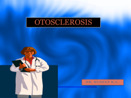 OTOSCLEROSIS  DR. SUDEEP K.C.    ANATOMY REVIEW:  OTIC LABYRINTH OR MEMBRANOUS LABYRINTH OR ENDOLYMPHATIC.  PERIOTIC LABYRINTH OR PERILYMPHATIC LABYRINTH – SURROUNDS THE OTIC LABYRINTH.