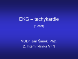 EKG – tachykardie (1.část)  MUDr. Jan Šimek, PhD. 2. Interní klinika VFN   Tachykardie Definice: zrychlená srdeční aktivita o frekvenci nad 100/min (Tedy QRS komplexy jsou vzdáleny.