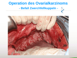Operation des Ovarialkarzinoms - Befall Zwerchfellkuppeln - Operation des Ovarialkarzinoms - Befall der Pleura -