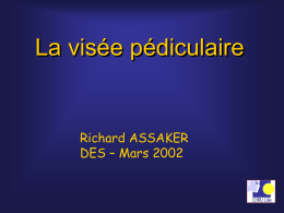 La visée pédiculaire  Richard ASSAKER DES – Mars 2002            • Choix de l’implant • Placement de l’implant • Monitoring   • Vis la plus longue possible • Diamètre.