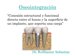 Oseointegración “Conexión estructural y funcional directa entre el hueso y la superficie de un implante, que soporta una carga”  Dr.