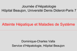 Journée d’Hépatologie Hôpital Beaujon, Université Denis Diderot-Paris 7  Atteinte Hépatique et Maladies de Système  Dominique-Charles Valla Service d’Hépatologie, Hôpital Beaujon.