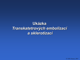 Ukázka Transkatetrových embolizací a sklerotizací  © OIR Olomouc 2007 Embolizace aneuryzmatu a. comm.
