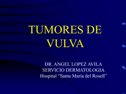 TUMORES DE VULVA DR. ANGEL LOPEZ AVILA SERVICIO DERMATOLOGIA Hospital “Santa María del Rosell”   CLASIFICACION • TUMORES BENIGNOS de vulva • TUMORES MALIGNOS de vulva   T.