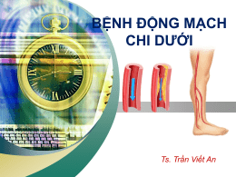 “ Add your company slogan ”  BỆNH ĐỘNG MẠCH CHI DƯỚI  LOGO Ts. Trần Viết An www.themegallery.com.