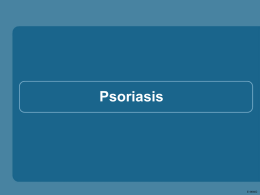 Psoriasis  E-00602   Psoriasis • La psoriasis es una patología inmunoinflamatoria crónica de la piel 1 • La forma más común es la psoriasis crónica.