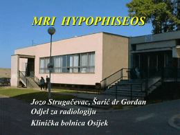 MRI HYPOPHISEOS  Jozo Strugačevac, Šarić dr Gordan Odjel za radiologiju Klinička bolnica Osijek   O APARATU  - MAGNEX EPIOS 5 – SHIMADZU 0,5 TESLA  D – 200