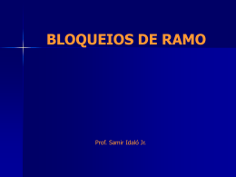 BLOQUEIOS DE RAMO  Prof. Samir Idaló Jr.   Sistema de Condução Intraventricular   Feixe de His e seus Ramos   Feixe de His e seus Ramos    ECG Normal   ECG normal  Plano.