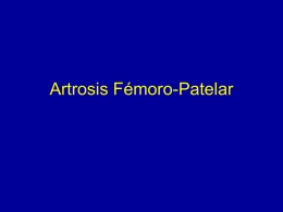 Artrosis Fémoro-Patelar   Tróclea Femoral  Plica infra-patelar  Ligamento adiposo  Rótula   Corte sagital de la rodilla que muestra el espesor considerable de los cartílagos de la rótula y.