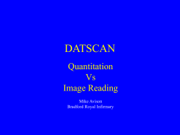 DATSCAN Quantitation Vs Image Reading Mike Avison Bradford Royal Infirmary Overview • Simple quantitation of SPECT slices implemented on Odyssey • How reproducible is it?  • How does it.