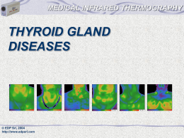 MEDICAL INFRARED THERMOGRAPHY  THYROID GLAND DISEASES  © EDP Srl, 2004 http://www.edpsrl.com   MEDICAL INFRARED THERMOGRAPHY Thyroid Gland Diseases Infrared thermography is a very good method for express and screening.