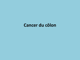 Cancer du côlon   Épidémiologie 1 • C'est le second cancer, en terme de fréquence, chez la femme (après le cancer du sein) et.