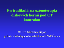 Periradikulárna ozónoterapia diskových hernií pod CT kontrolou MUDr. Miroslav Gajan primár rádiologického oddelenia KNsP Čadca.