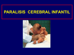 PARALISIS CEREBRAL INFANTIL   Qué es parálisis cerebral infantil (PCI)  “ trastorno del tono postural y del movimiento, de carácter persistente ( no invariable.