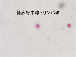 髄液好中球とリンパ球 - 千葉県臨床検査技師会